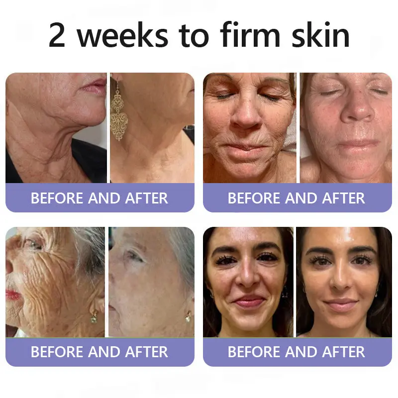 Wrinkle-Reducing & Lifting Roller Cream - Image 10