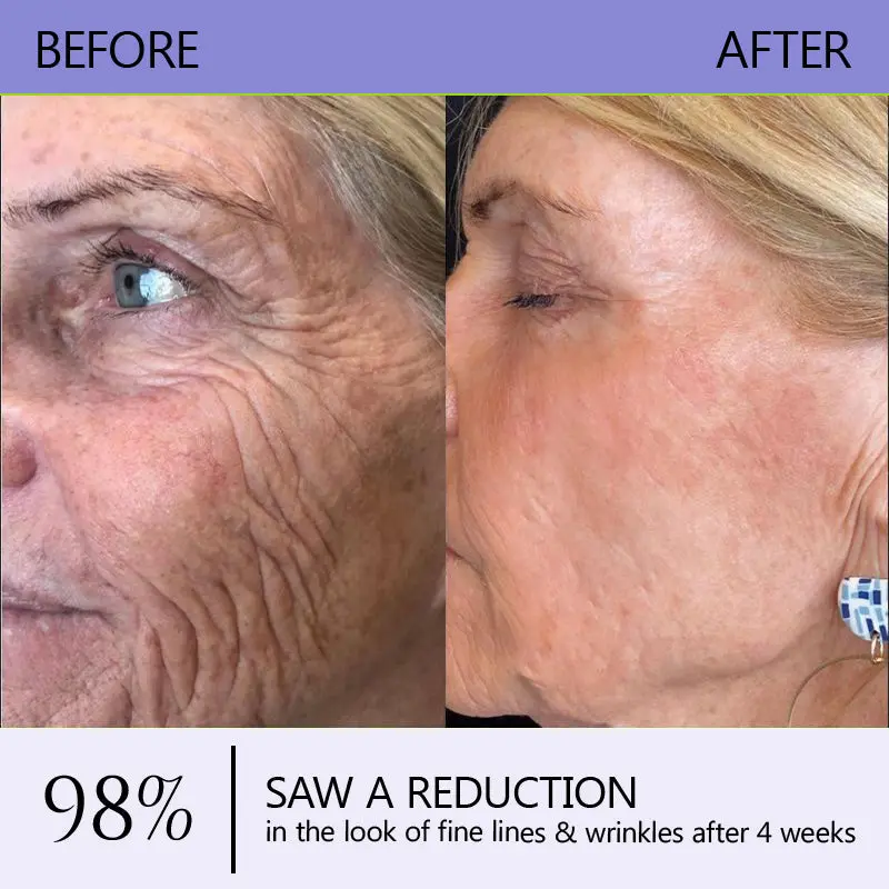 Wrinkle-Reducing & Lifting Roller Cream - Image 12