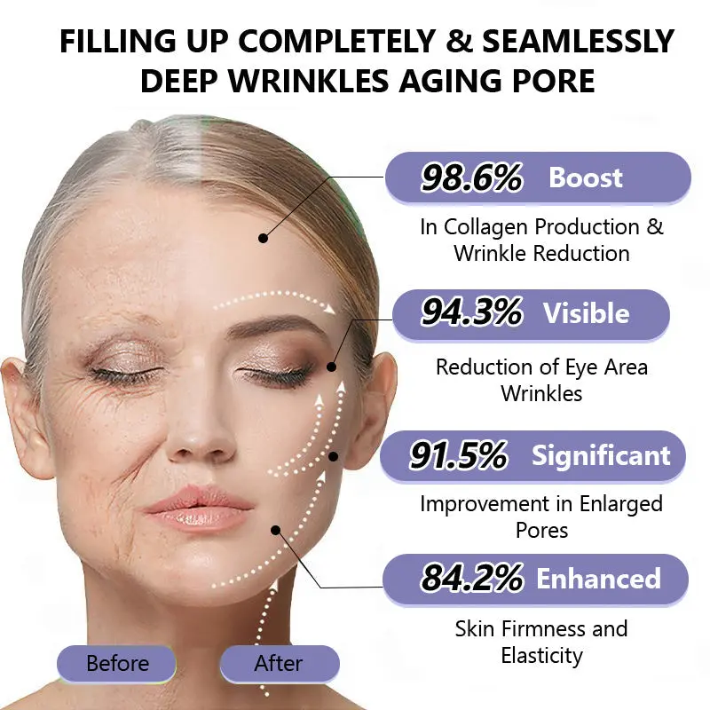Wrinkle-Reducing & Lifting Roller Cream - Image 15