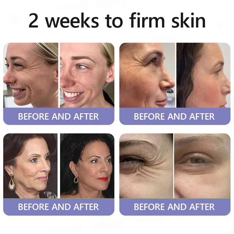 Wrinkle-Reducing & Lifting Roller Cream - Image 9