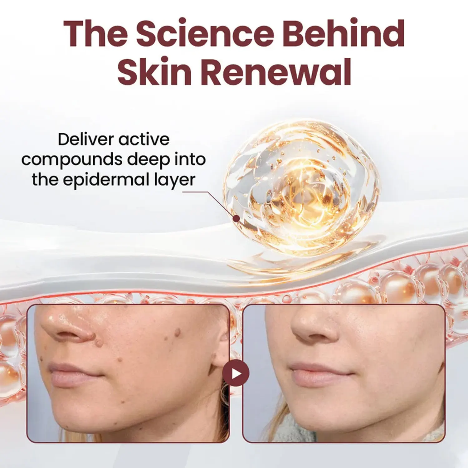 KeraErase Dual-Action Renewal Cream - Image 5