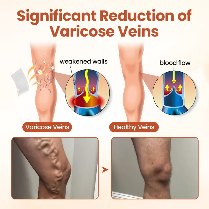 -VeinTarget Microneedle Patch - Image 5