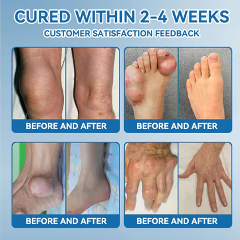 Joint Healing Cream - Image 7