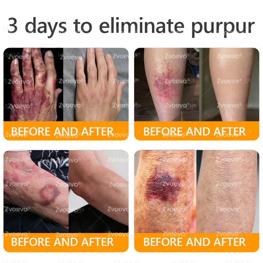 Bee Venom Skin Restoration Cream - Image 3