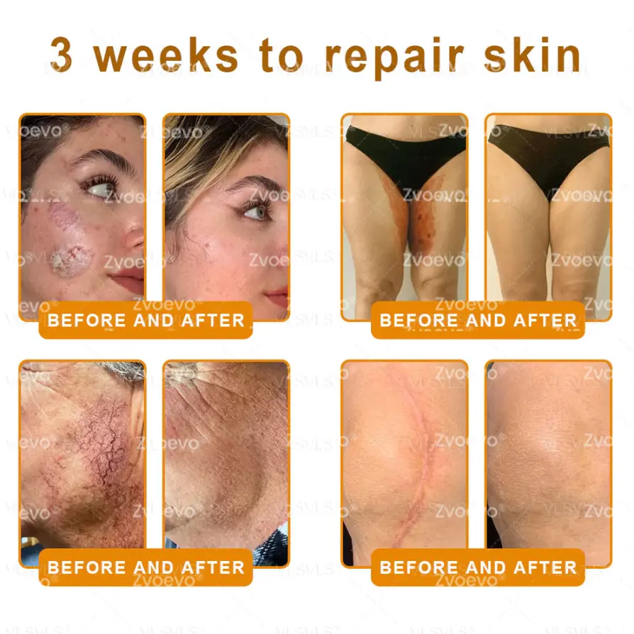 Bee Venom Skin Restoration Cream - Image 4