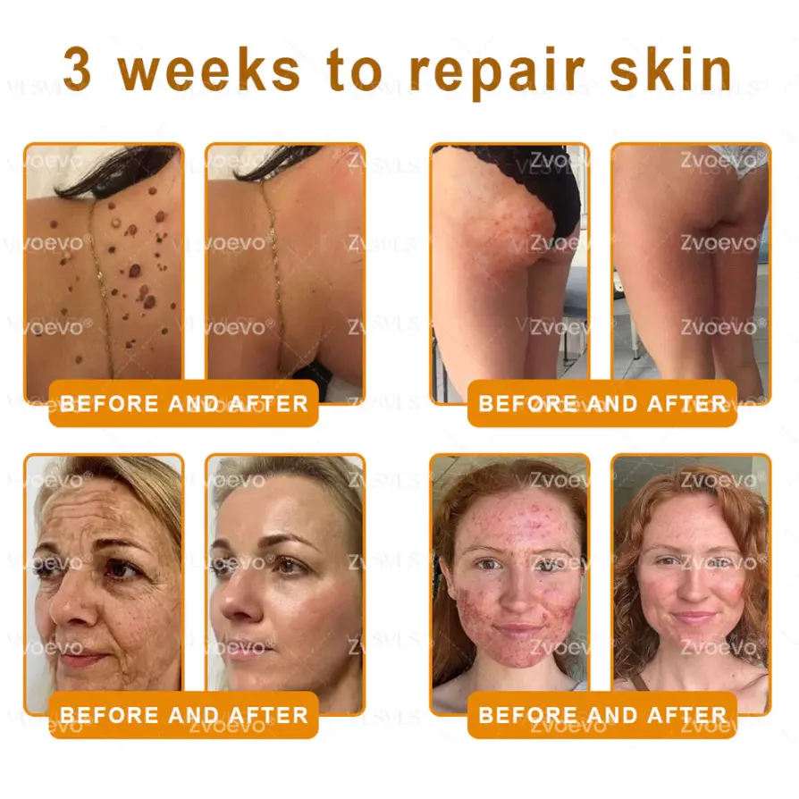 Bee Venom Skin Restoration Cream - Image 5
