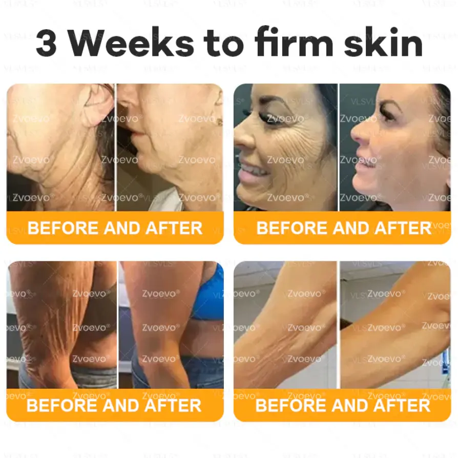 Bee Venom Skin Restoration Cream - Image 8