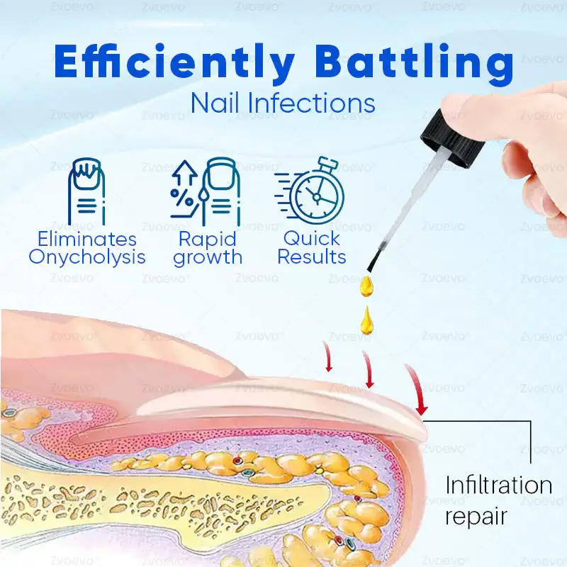 OnyxoGuard Nail Growth and Repair Serum - Image 4