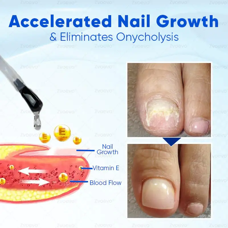 OnyxoGuard Nail Growth and Repair Serum - Image 5