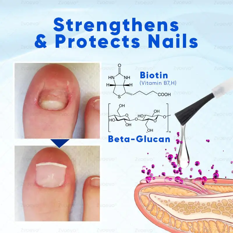 OnyxoGuard Nail Growth and Repair Serum - Image 6