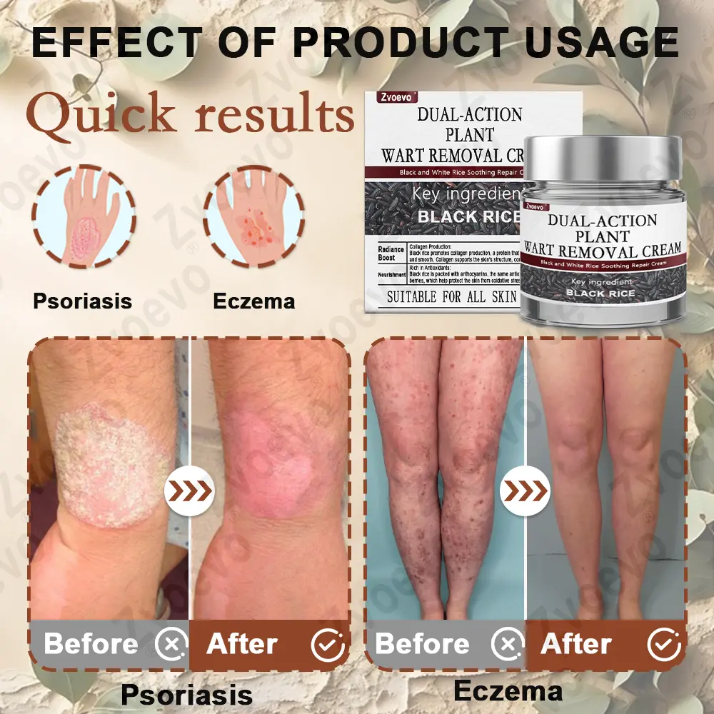Rice Bran Essence Cream - Image 11