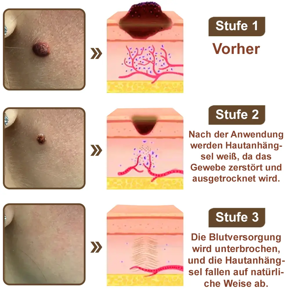 Schwarzer Reis Hautreparatur Essenzcreme - Image 10