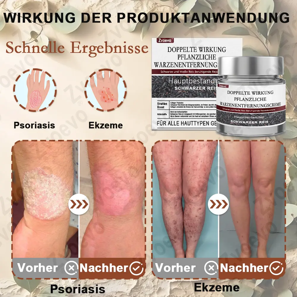Schwarzer Reis Hautreparatur Essenzcreme - Image 11