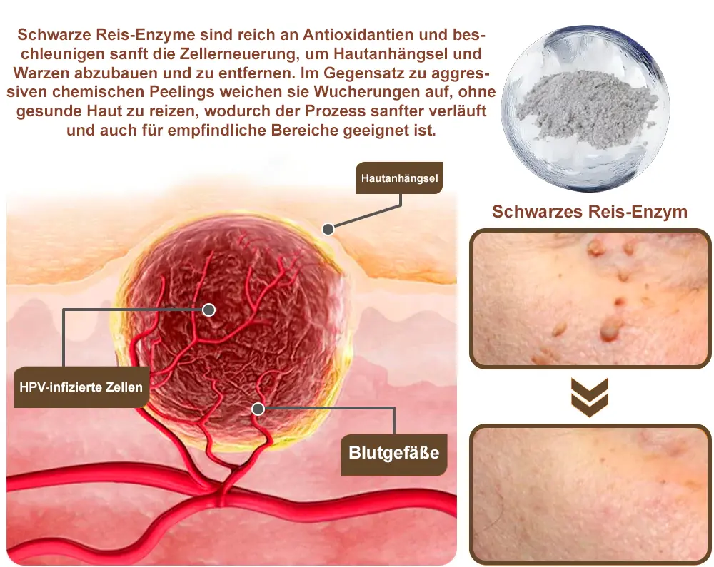 Schwarzer Reis Hautreparatur Essenzcreme - Image 9