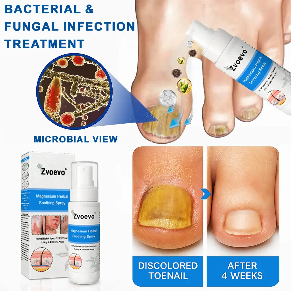 Magnesium Herbal Psoriasis Spray - Image 7