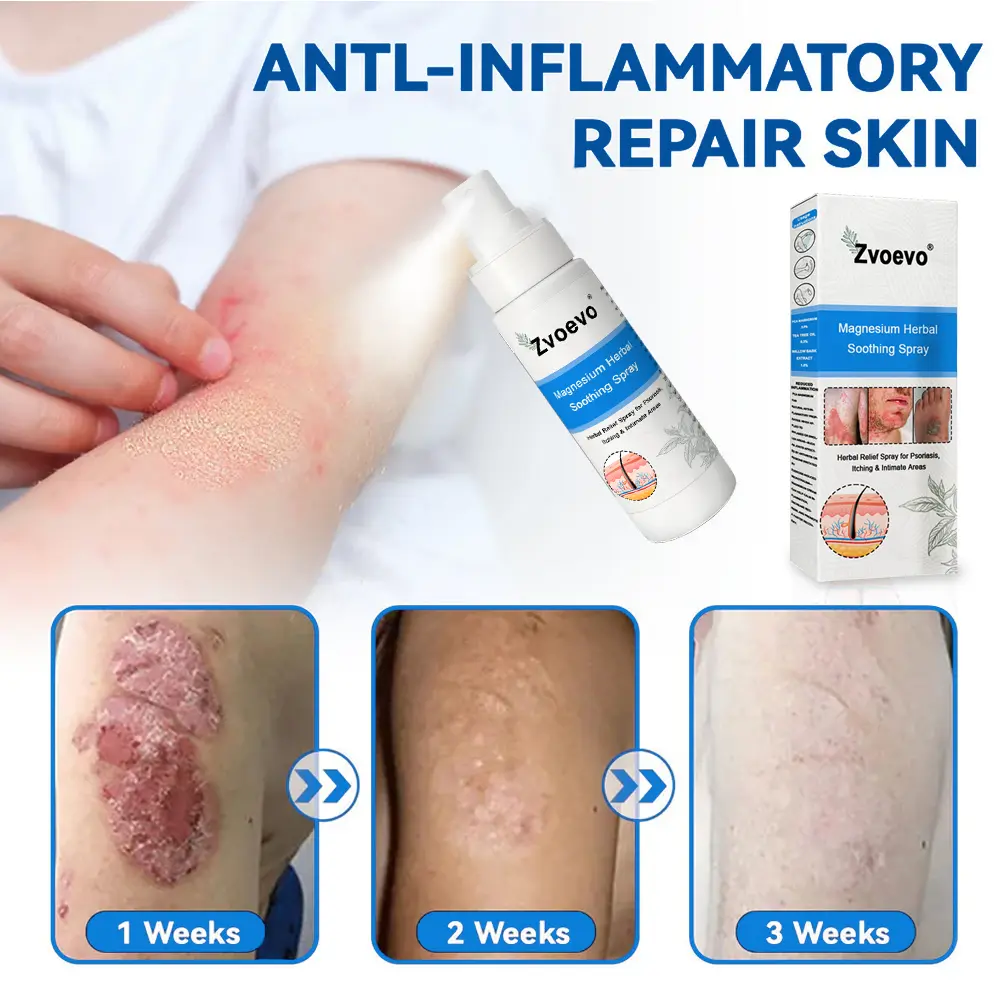 Magnesium Herbal Psoriasis Spray - Image 8