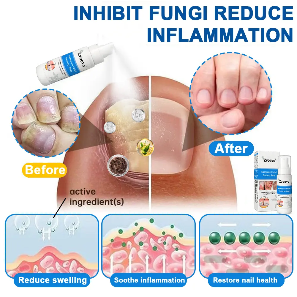 Magnesium Herbal Psoriasis Spray - Image 9