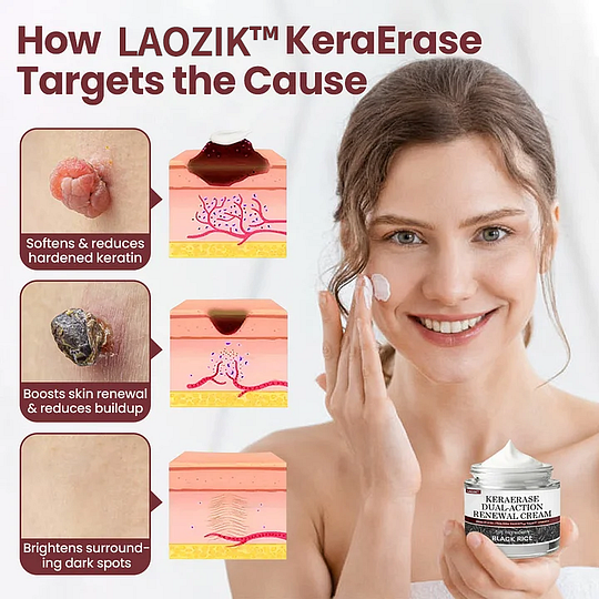 KeraErase Dual-Action Renewal Cream - Image 4