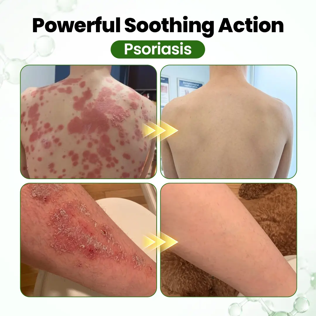 DermaOat Botanical Barrier Cream - Image 2