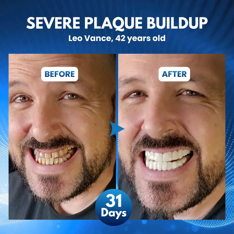 ProDenti Tideglusib Tooth and Gum Repair Oral Strips - Image 2