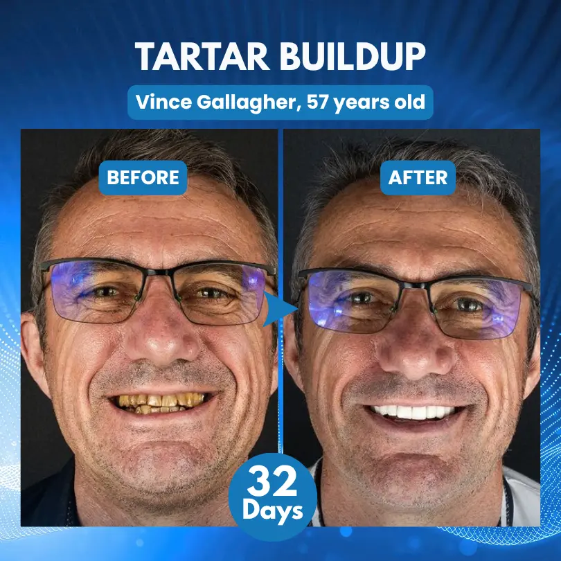ProDenti Tideglusib Tooth and Gum Repair Oral Strips - Image 3