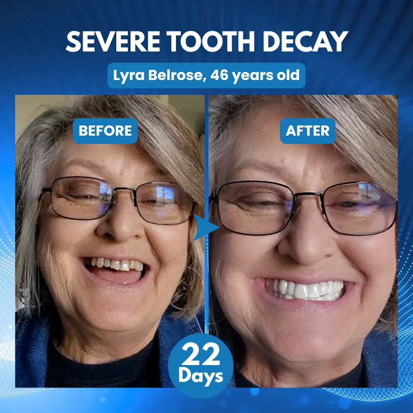 ProDenti Tideglusib Tooth and Gum Repair Oral Strips - Image 4