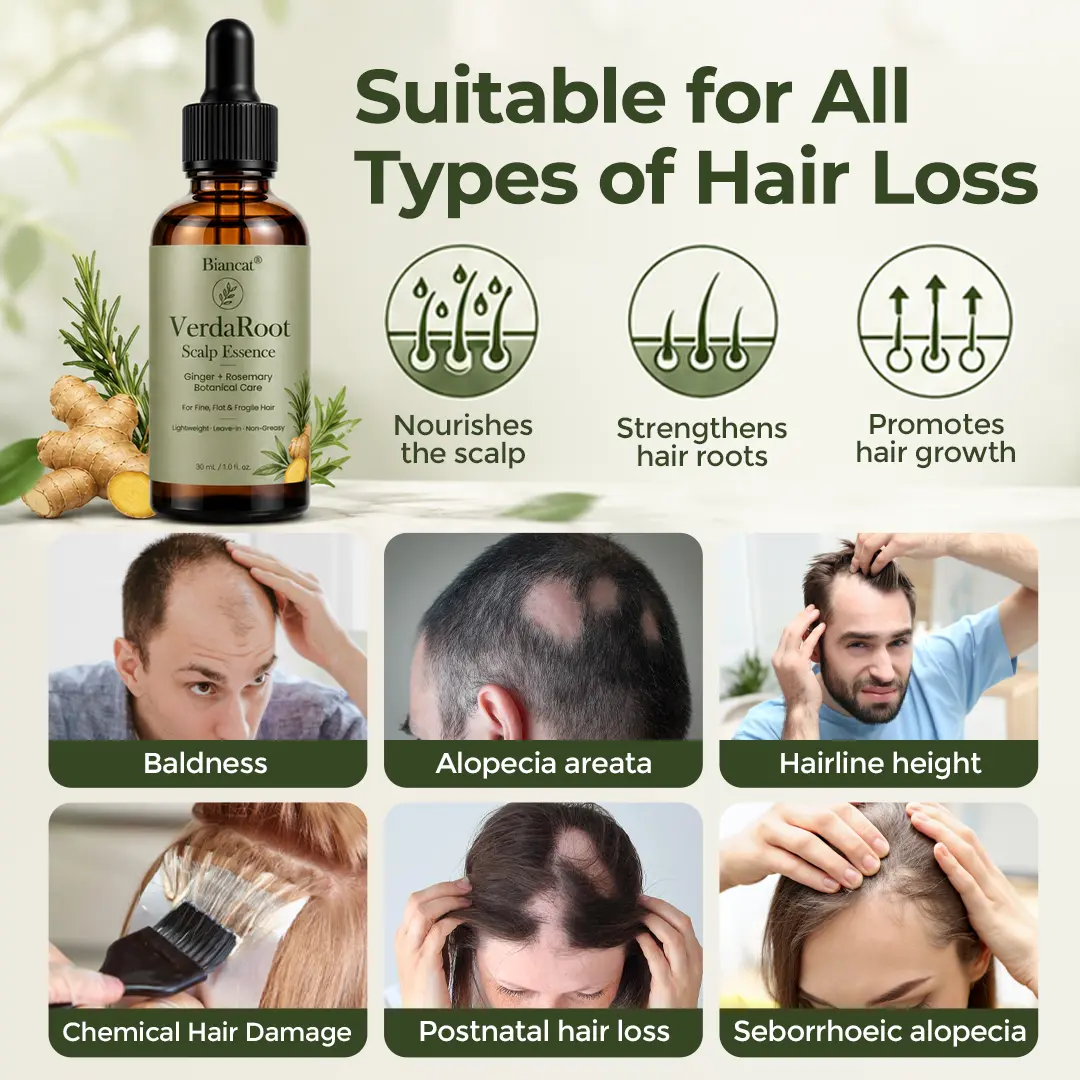 VerdaRoot Scalp Essence - Image 4