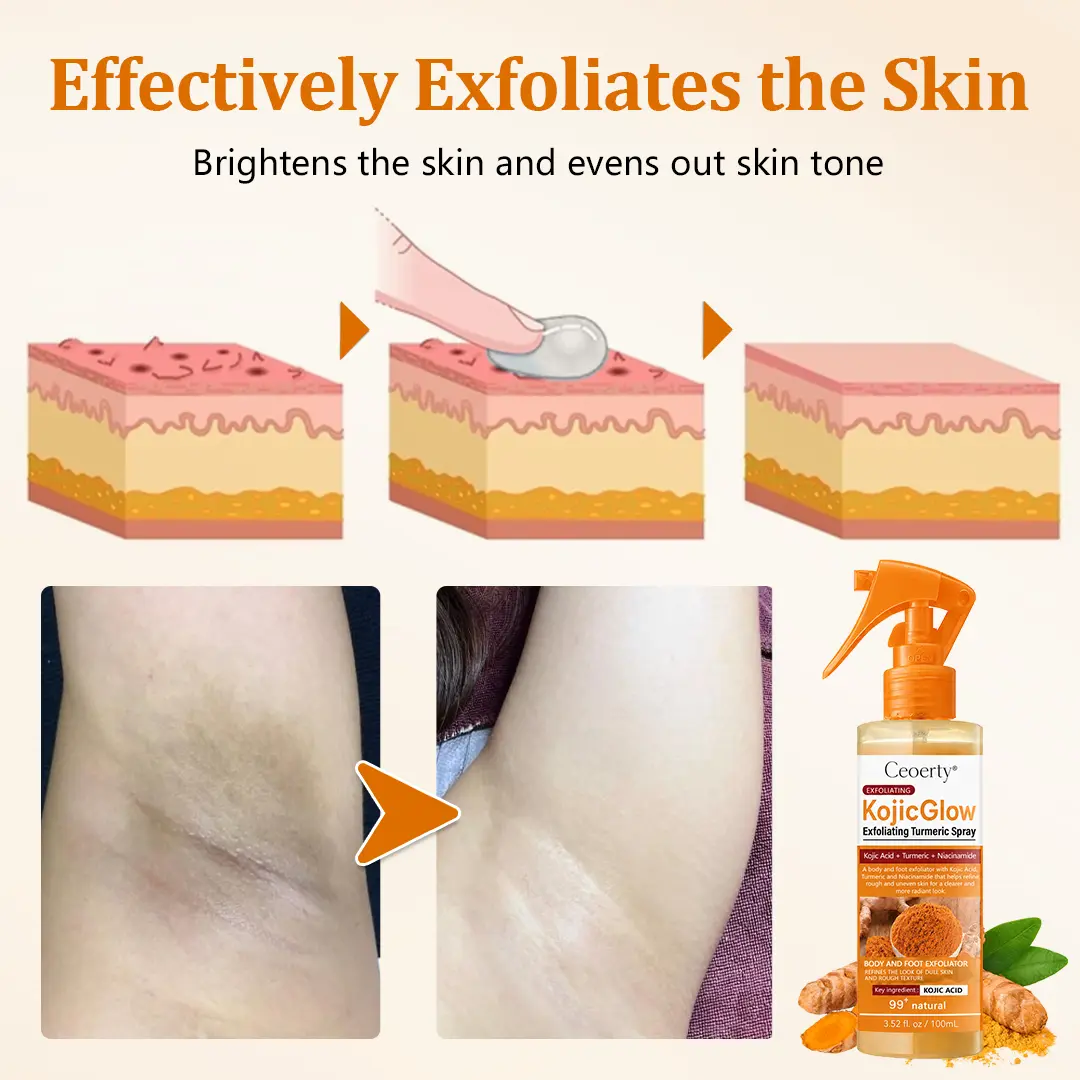 KojicGlow Exfoliating Turmeric Spray - Image 6