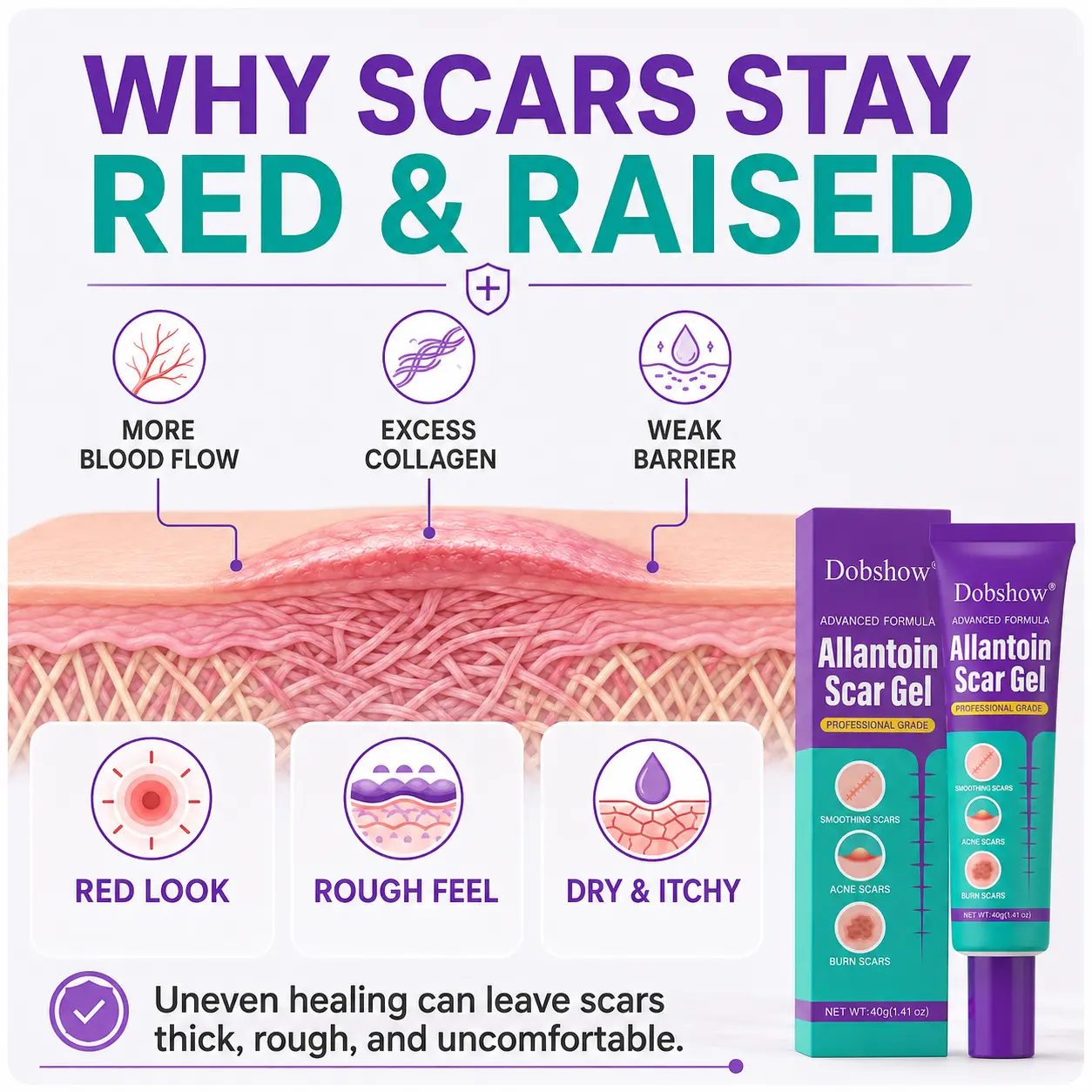 Allantoin Scar Gel - Image 3