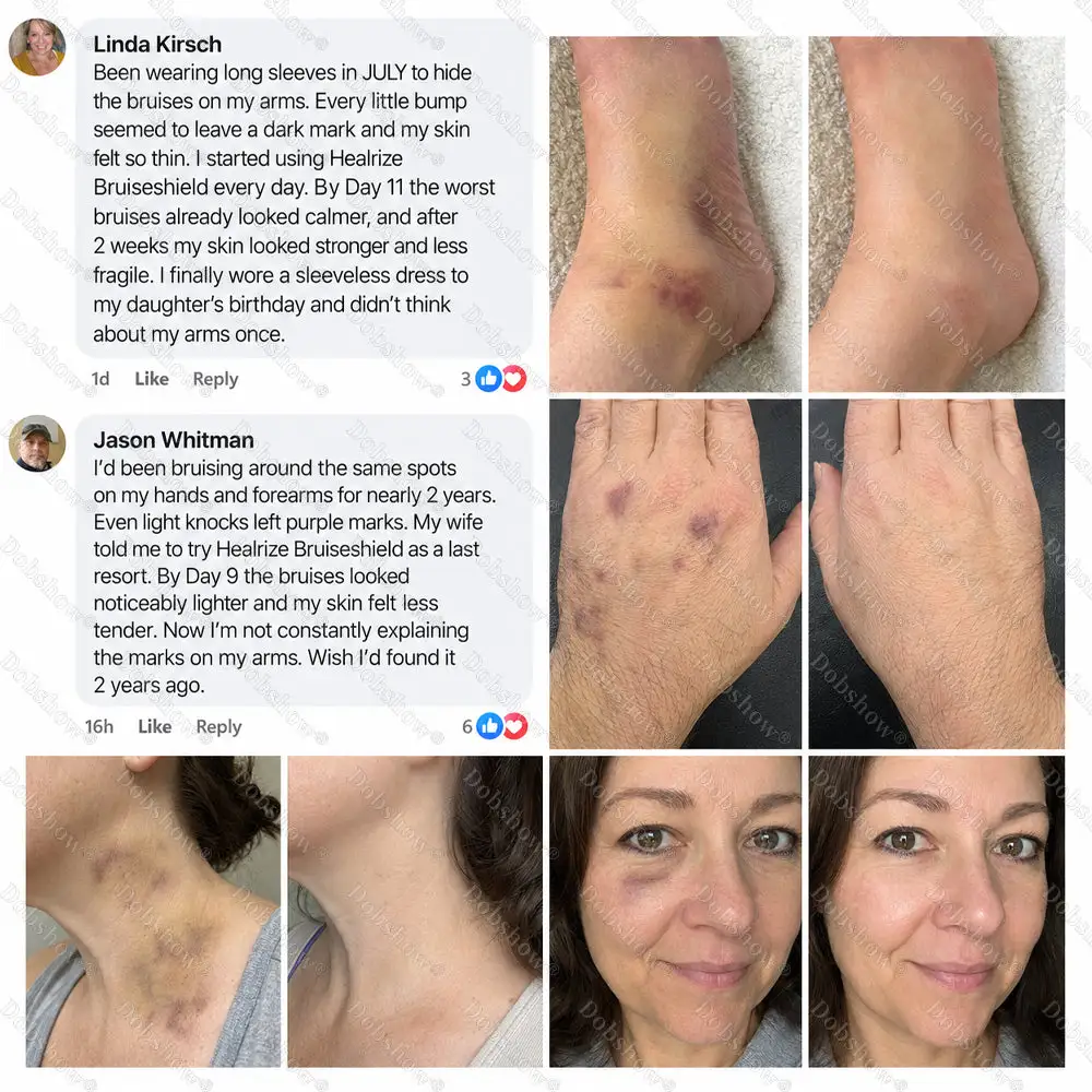 BRUISESHIELD Skin Strengthening Cream - Image 2