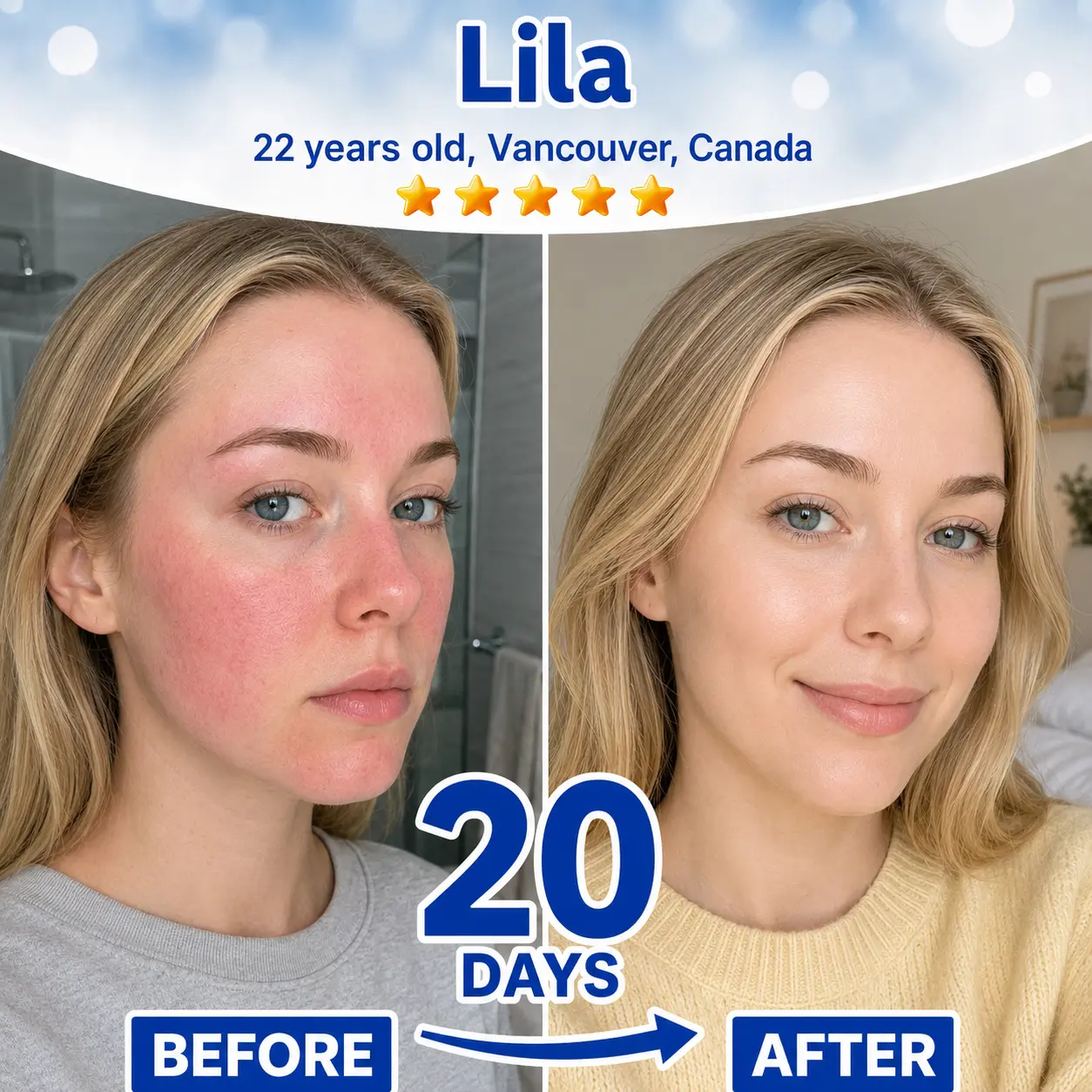 Skin Renewal Duo - Image 4