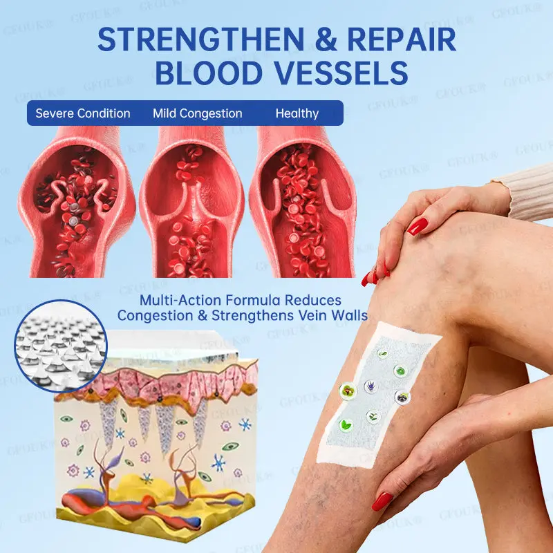 VeinRelief Microneedle Patch - Image 6