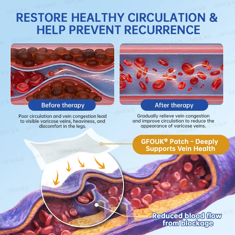 VeinRelief Microneedle Patch - Image 7