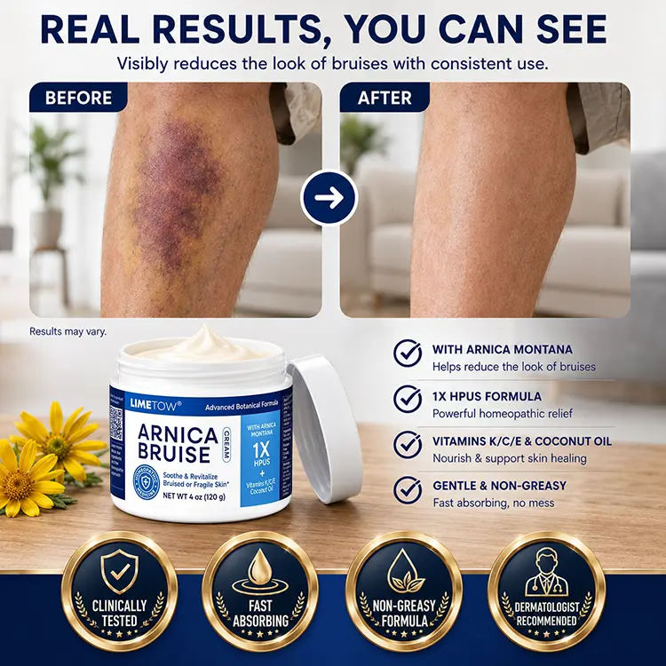 LIMETOW® Arnica Bruise Cream