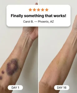 LIMETOW® BRUISE CREAM