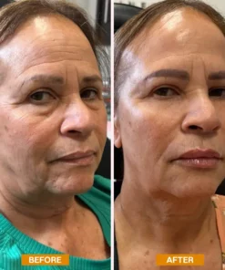 LIMETOW® Retinol Eyebag Cream