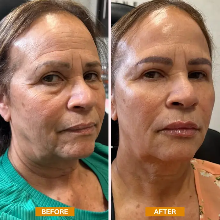 LIMETOW® Retinol Eyebag Cream