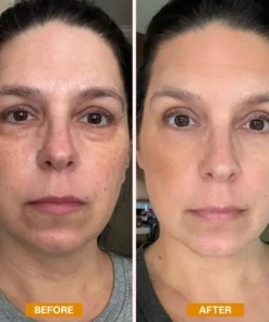 LIMETOW® Retinol Eyebag Cream