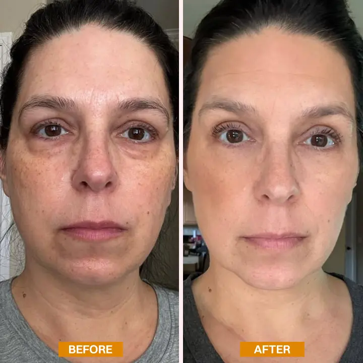 LIMETOW® Retinol Eyebag Cream