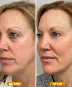 LIMETOW® Retinol Eyebag Cream