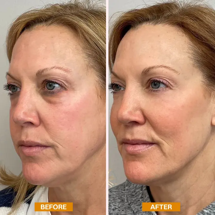 LIMETOW® Retinol Eyebag Cream