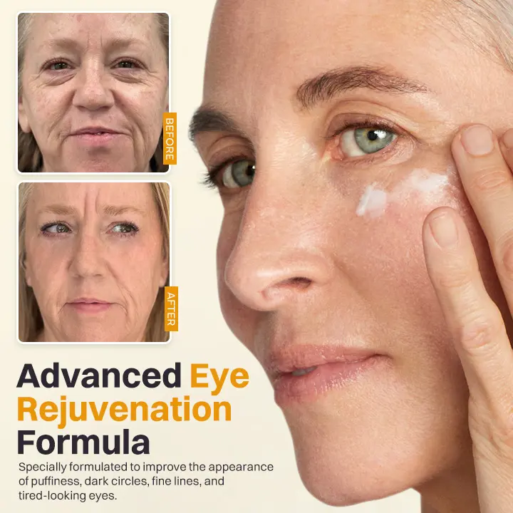 LIMETOW® Retinol Eyebag Cream