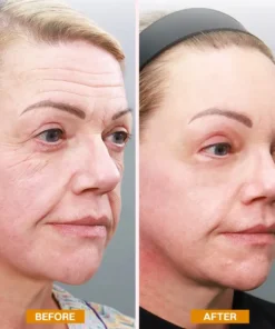 LIMETOW® Retinol Eyebag Cream
