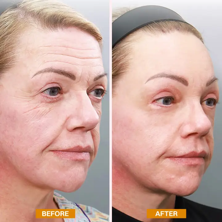 LIMETOW® Retinol Eyebag Cream