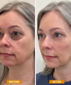 LIMETOW® Retinol Eyebag Cream