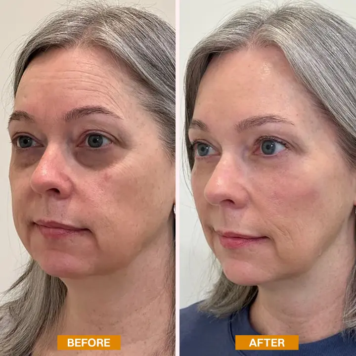 LIMETOW® Retinol Eyebag Cream
