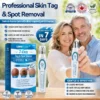 LIMETOW® Skin Tag & Spot Eraser