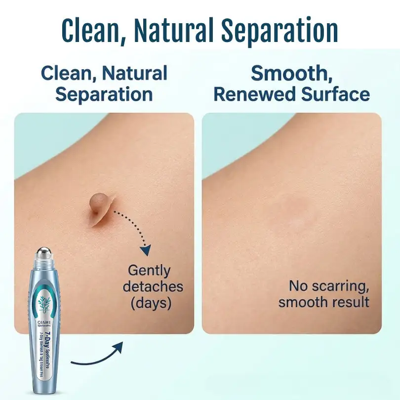SpotlessPro Advanced Skin Care Pen - Image 9