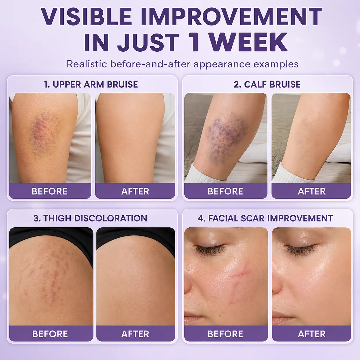 BruiseFade Pro Skin Repair Cream - Image 5