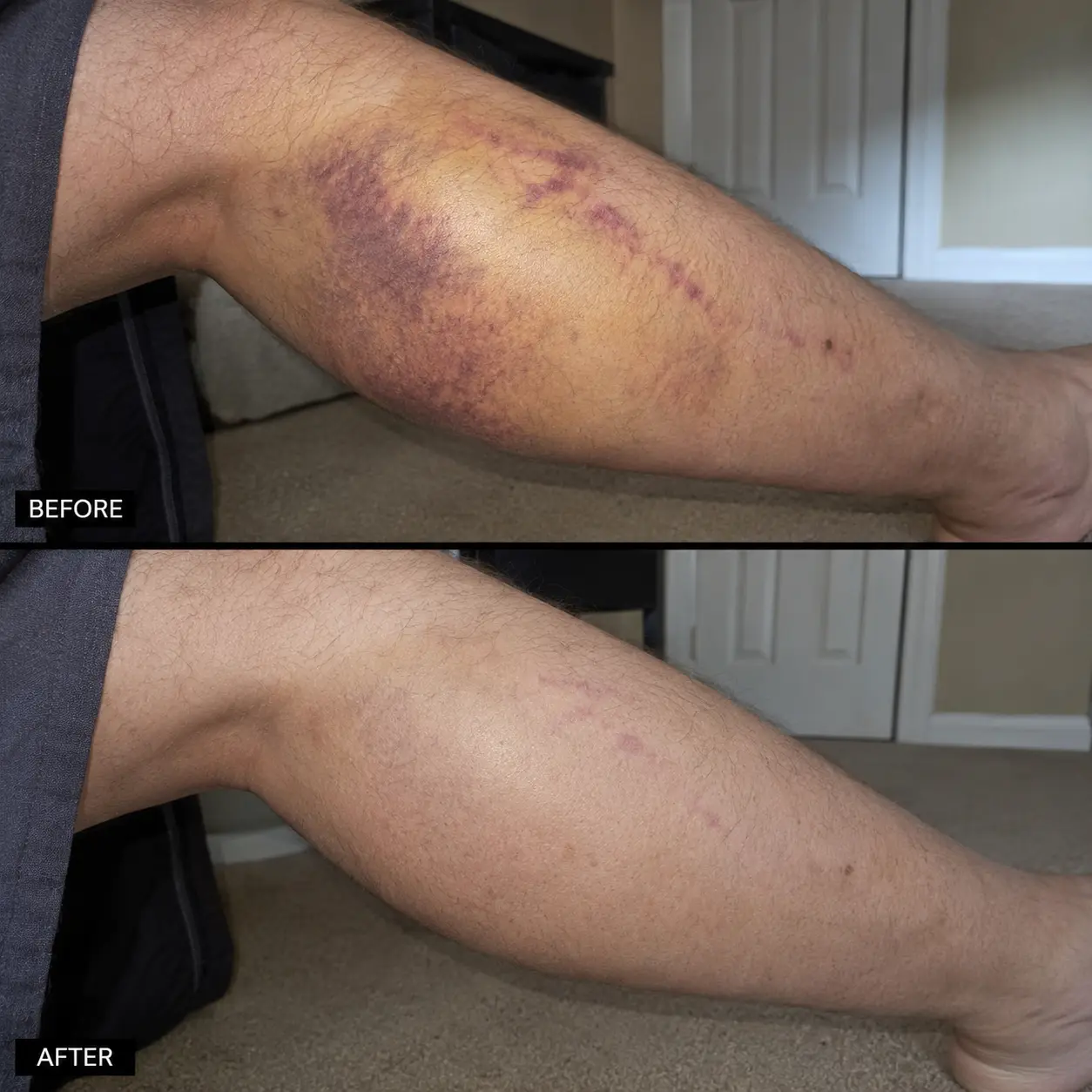 BruiseFade Pro Skin Repair Cream - Image 7